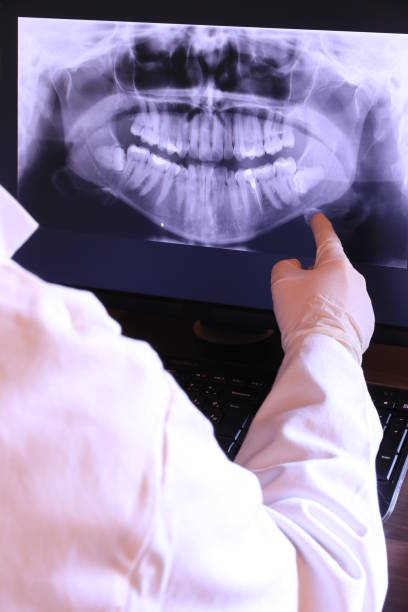 Best Emergency Dental Care for Sports Injuries in Porter, IN